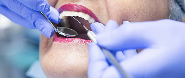Best Emergency Dental Care for Broken or Chipped Teeth in Silt, CO